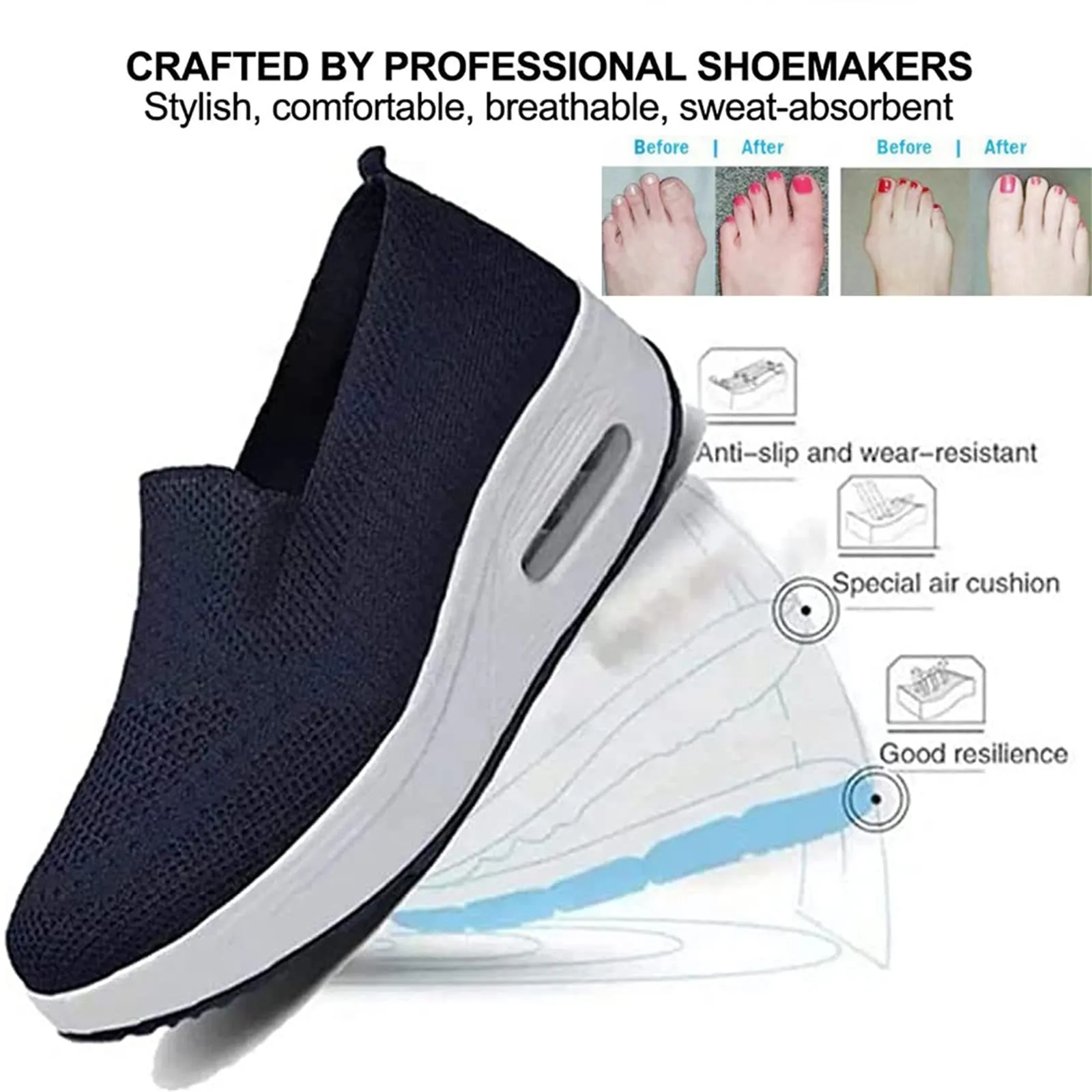Fitsshoes Women's Orthopedic Sneakers, Easyfrot Orthopedic Sneakers, Orthopedic Slip on Sneakers for Women